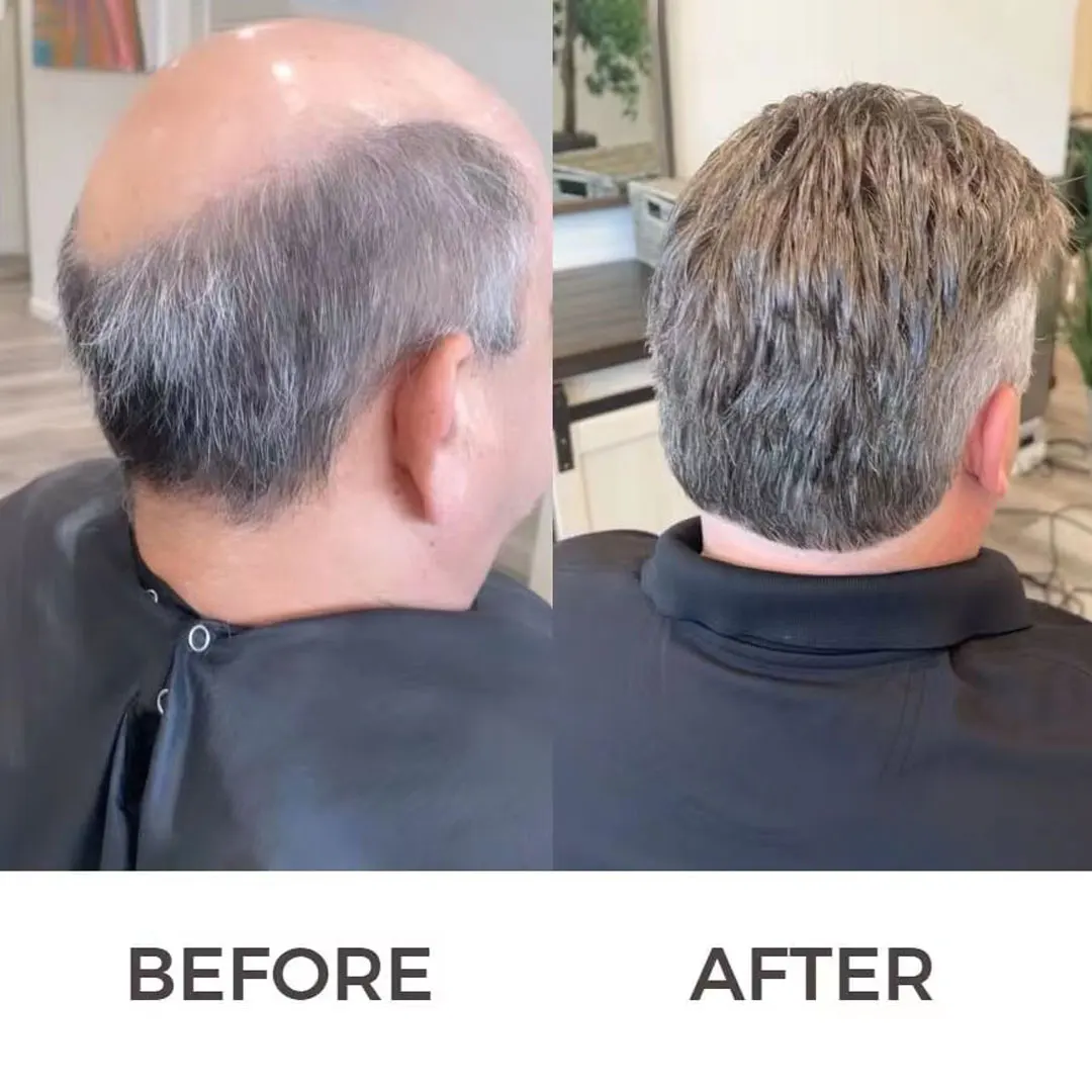 Men Toupee Human Hair Mix Grey Hair Replacement System Prosthesis Welded Fine Mono With Npu Men Wig Toupee