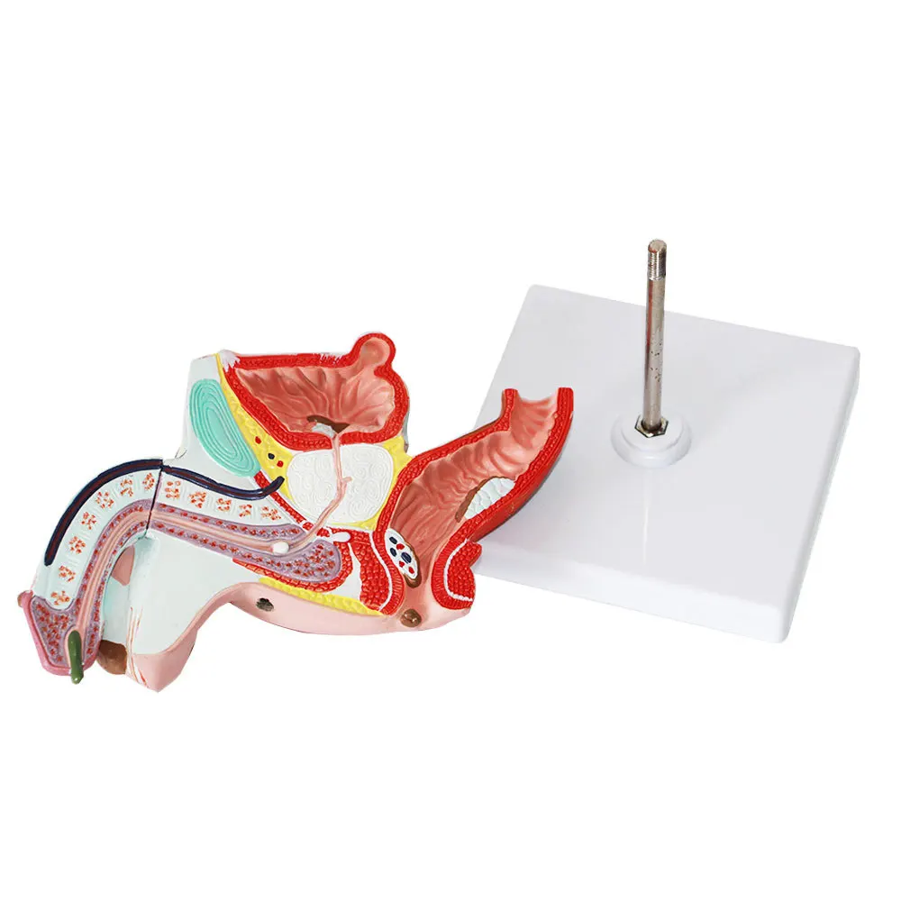 Male anatomical model of internal and external organs Male gonorrhea model Medical teaching equipment