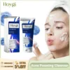 Facial Cleanser Anti Acne Oil Control Blackhead Remover Shrink Pores Deep Cleansing Acne Treatment Moisturizing Face Wash 100g 1