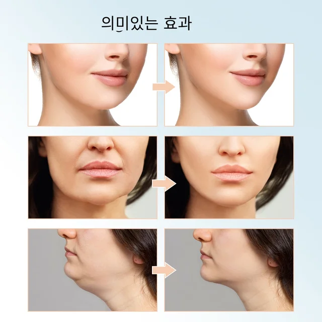 얼굴 슬리밍과 리프팅을 도와주는 제품