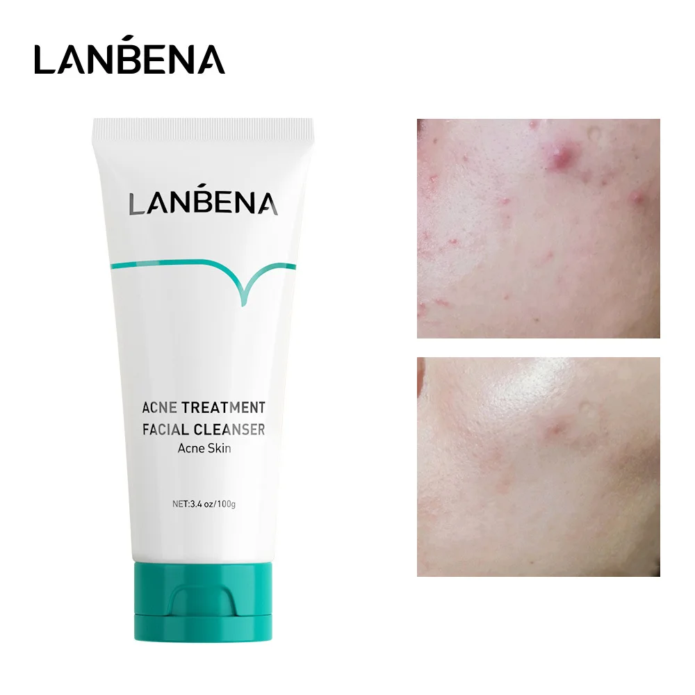 

Очищающее средство для лица LANBENA VC, отбеливающая очищающая пена для лица, против акне, фотоэтоин, золотой пептид 24K, антивозрастной уход за кожей, 100 г