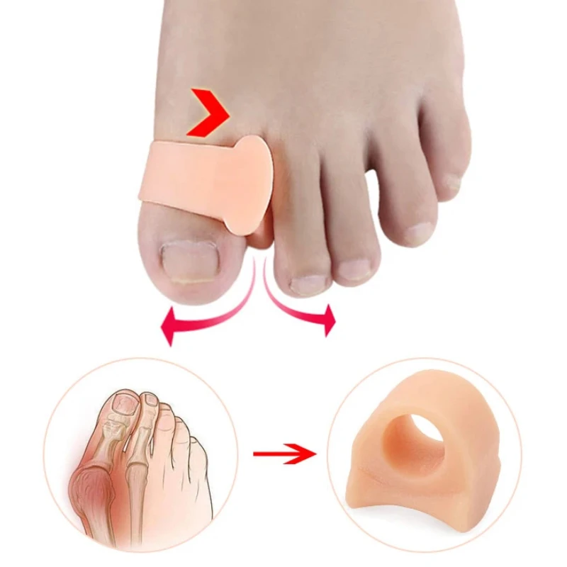 Рисунок 5 - = 5 пар, силиконовые разделители