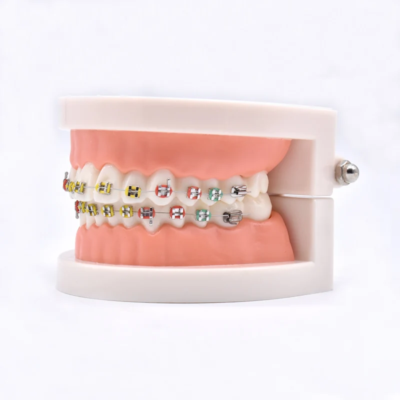 Dental Orthodontic Treatment Teeth Model With Bracket Arch Wire Buccal Tube Ligature Ties Dentist Lab Tooth Model Teaching Tools 6