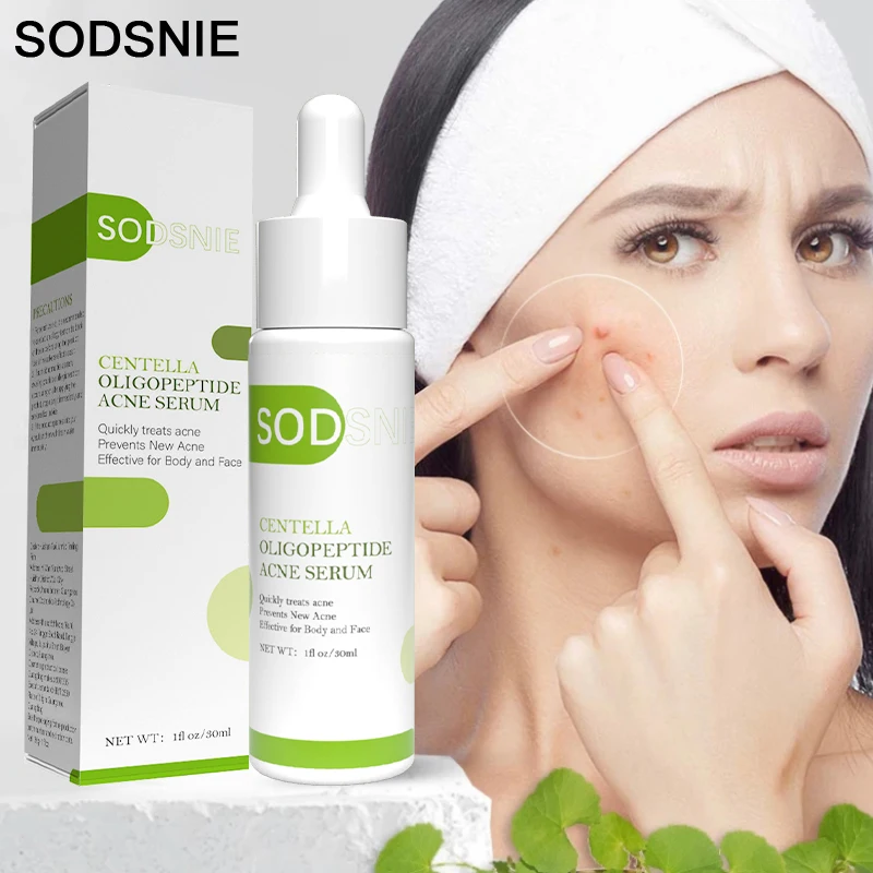 Centella Oligopeptide Acne Serum Remove Acne Lighten Acne Marks Relieve Redness Pimples Balance Oil Secretion Facial Care 30ml зубная паста e balance night gum care 2 шт по 200 мл