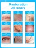 Laser scar repair 6