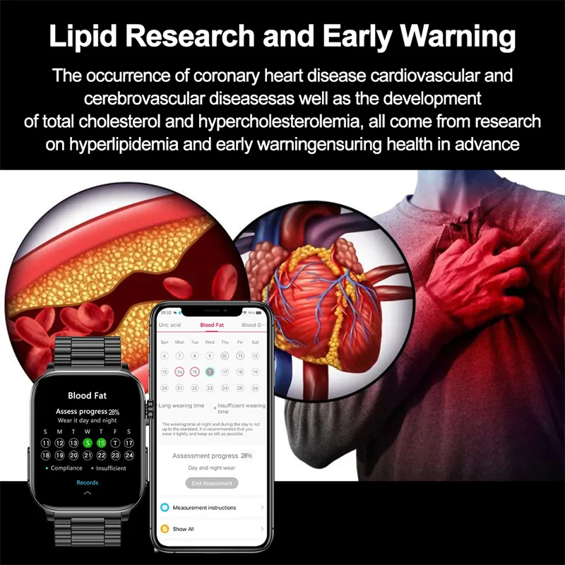Ʈ ġ  ȭ AI  ɹڼ ECG,   ǰ ͸,  ƮϽ,  Ʈġ, TK15