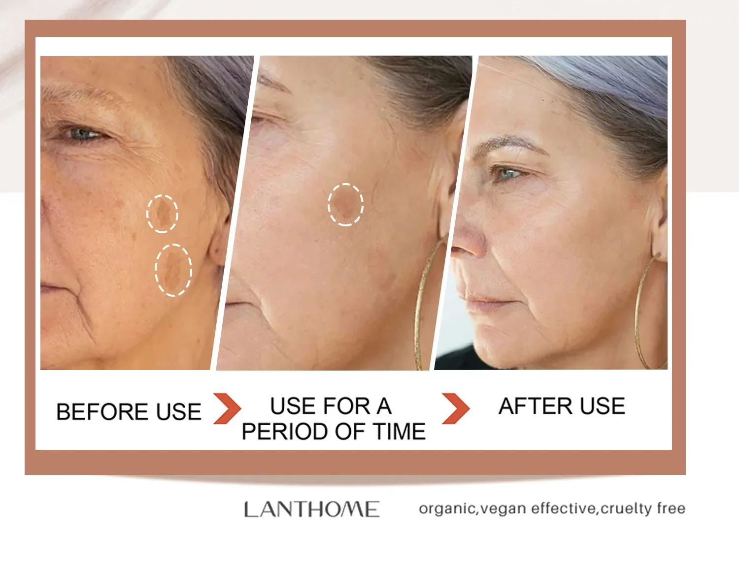 Glutathione Whitening Freckle Face Cream Remove Dark Spots Lighten Melasma Melanin Fade Acne Scars Anti-Aging_voghion.com