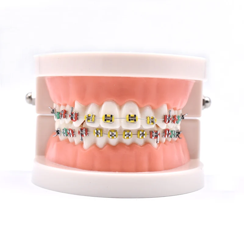 Dental Orthodontic Treatment Teeth Model With Bracket Arch Wire Buccal Tube Ligature Ties Dentist Lab Tooth Model Teaching Tools 2