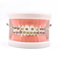 Dental Orthodontic Treatment Teeth Model With Bracket Arch Wire Buccal Tube Ligature Ties Dentist Lab Tooth Model Teaching Tools 2