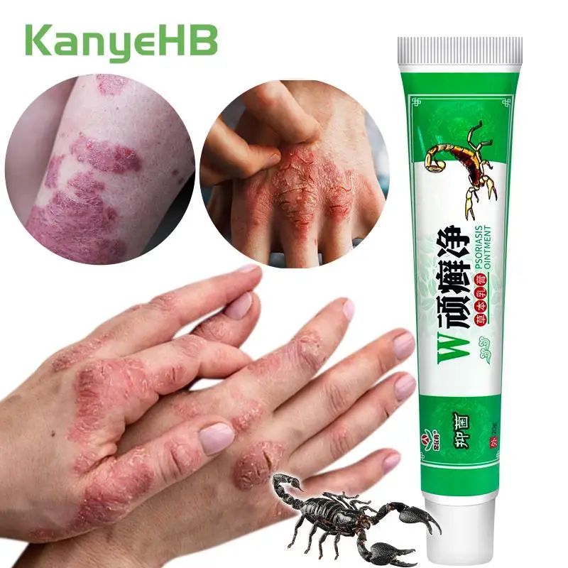 

1Pcs Psoriasis Antibacterial Cream Dermatitis Eczematoid Ointment Effective Anti-Itch Chinese Herb Medical Health Skin Care S091