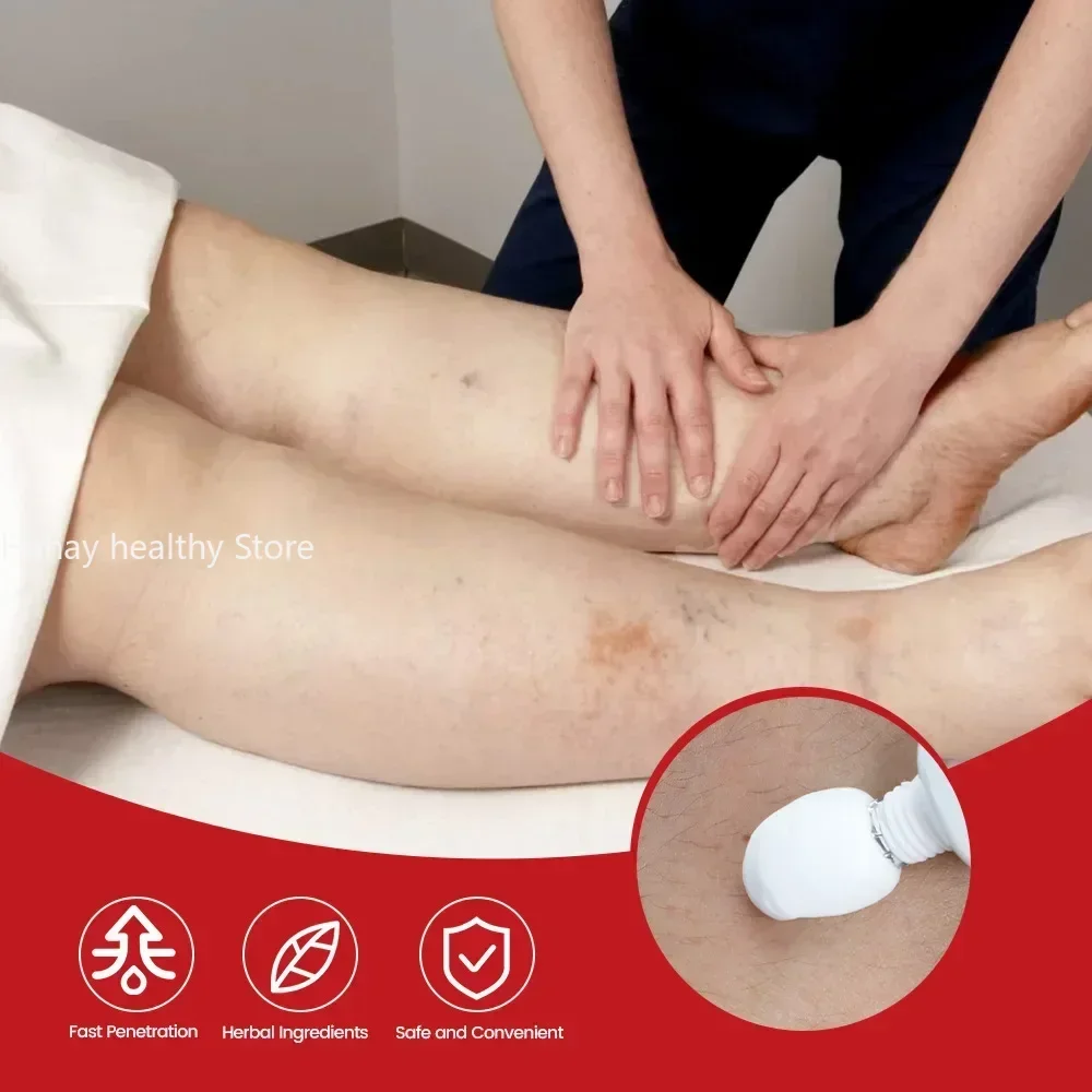Leg Repair Pen Improving Blood Circulation Varicose Veins Relieves Leg Bulge Discomfort Cream Skin Body Health Care