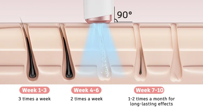 Ipl Laser Hair Removal Device For Face And Body With Ice Cooling_voghion.com