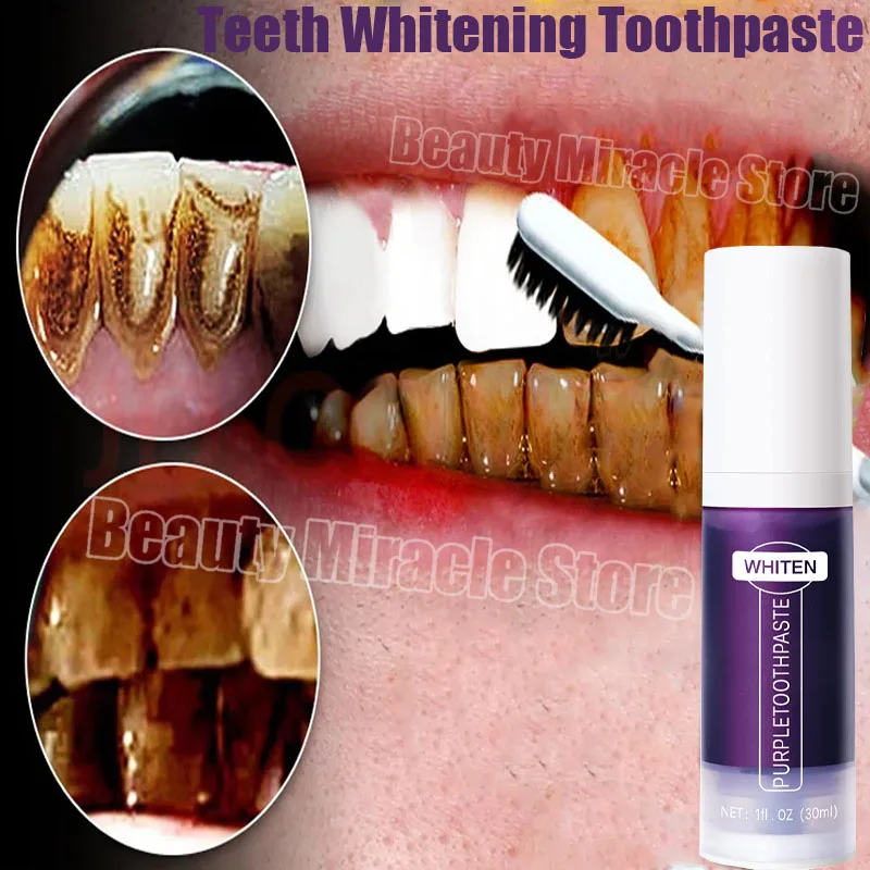 

V34 Teeth Whitening Toothpaste 5D Tooth Whitener Strips Oral Hygiene Cleaning Dental Bleaching Tools Fresh Breath Dentistry Care