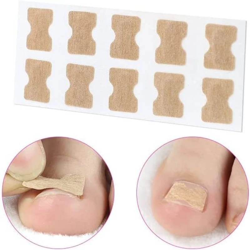 Toe Corrector Manicure Pedicure Tools Ingrown Toenail Straightening Clip Stainless Steel Treatment Onyxis Correction
