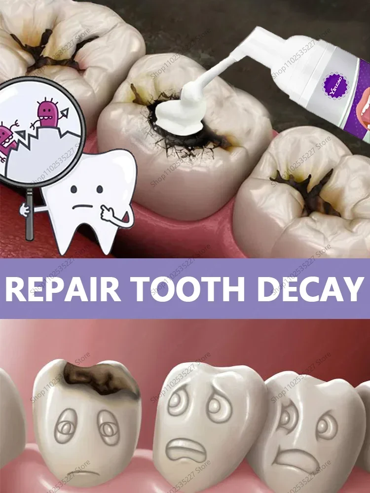 Tooth decay Repair Repairing