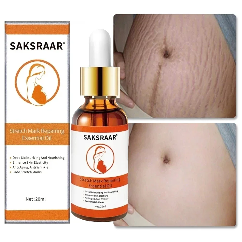 

Stretch Marks Remover Essential Oil Skin Care Treatment Cream For Stretch Mark Removal Maternity Slackline For Pregnant Oils