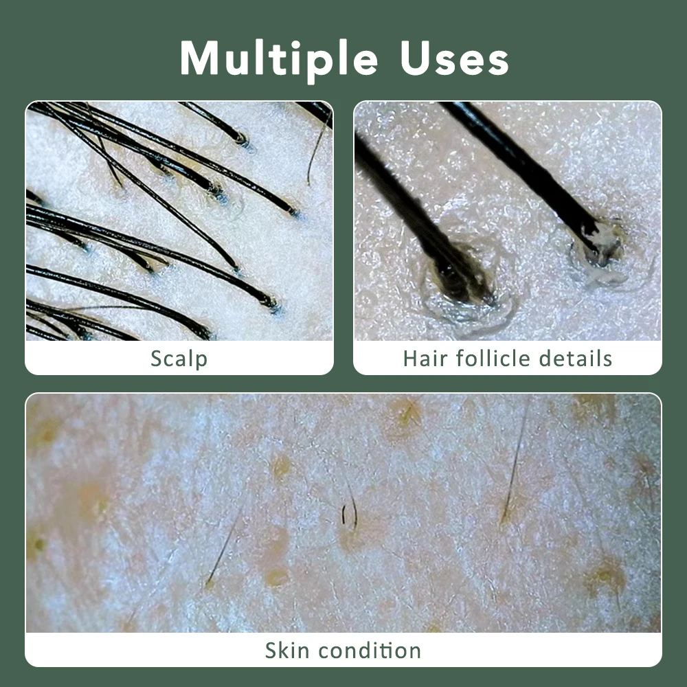 Portable HD Scalp Follicle Skin Analyzer Blackhead Pore Detection Device Multi Function Skin Test Instrument Hair Analyzer