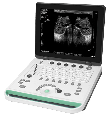 

Portable ultrasound machine gynecology B ultrasound machineportable ultrasound price