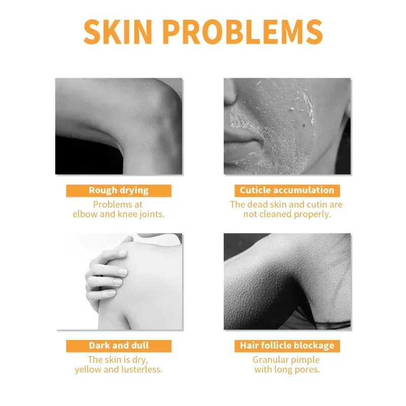Papaya Peeling Gel Facial skin removal melanin Whitening Repair brighten body care exfoliating Moisturizing Cream