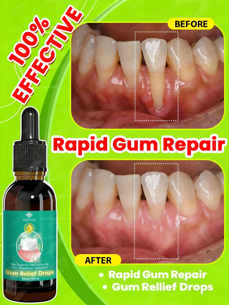 Oral care tools, the top choice on the annual bestseller list，Eᴀsɪʟʏ ʀᴇɢᴇɴᴇʀᴀᴛᴇ ɢᴜᴍs ᴀɴᴅ ᴄᴏᴠᴇʀ ᴛᴇᴇᴛʜ ɪɴ 7 ᴅᴀʏs