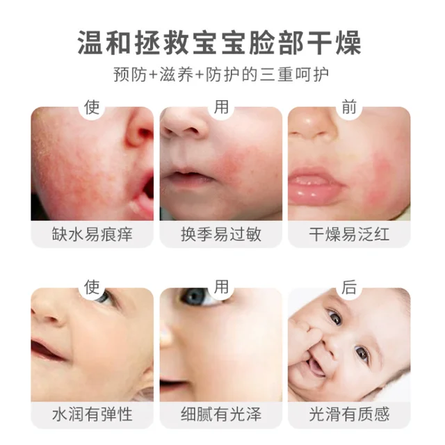 Baby Face Cream, Children's Soft Moisturizing Cream, Moisturizing Baby Cream, Moisturizing Skin Care Lotion 50g  Cream 3