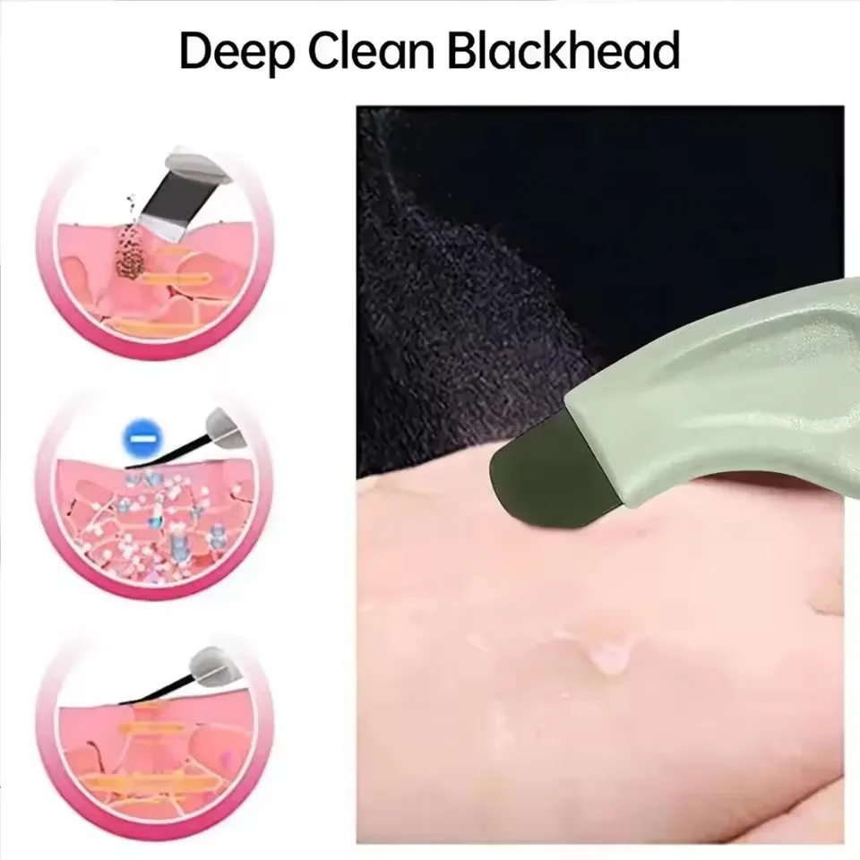 Handheld Facial Blackhead Removal Tool for Deep Cleansing