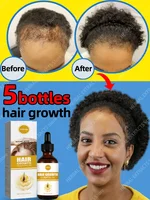 The best-selling hair growth product in Asia. From today, you will no longer be troubled by hair loss and baldness. Find your be 1