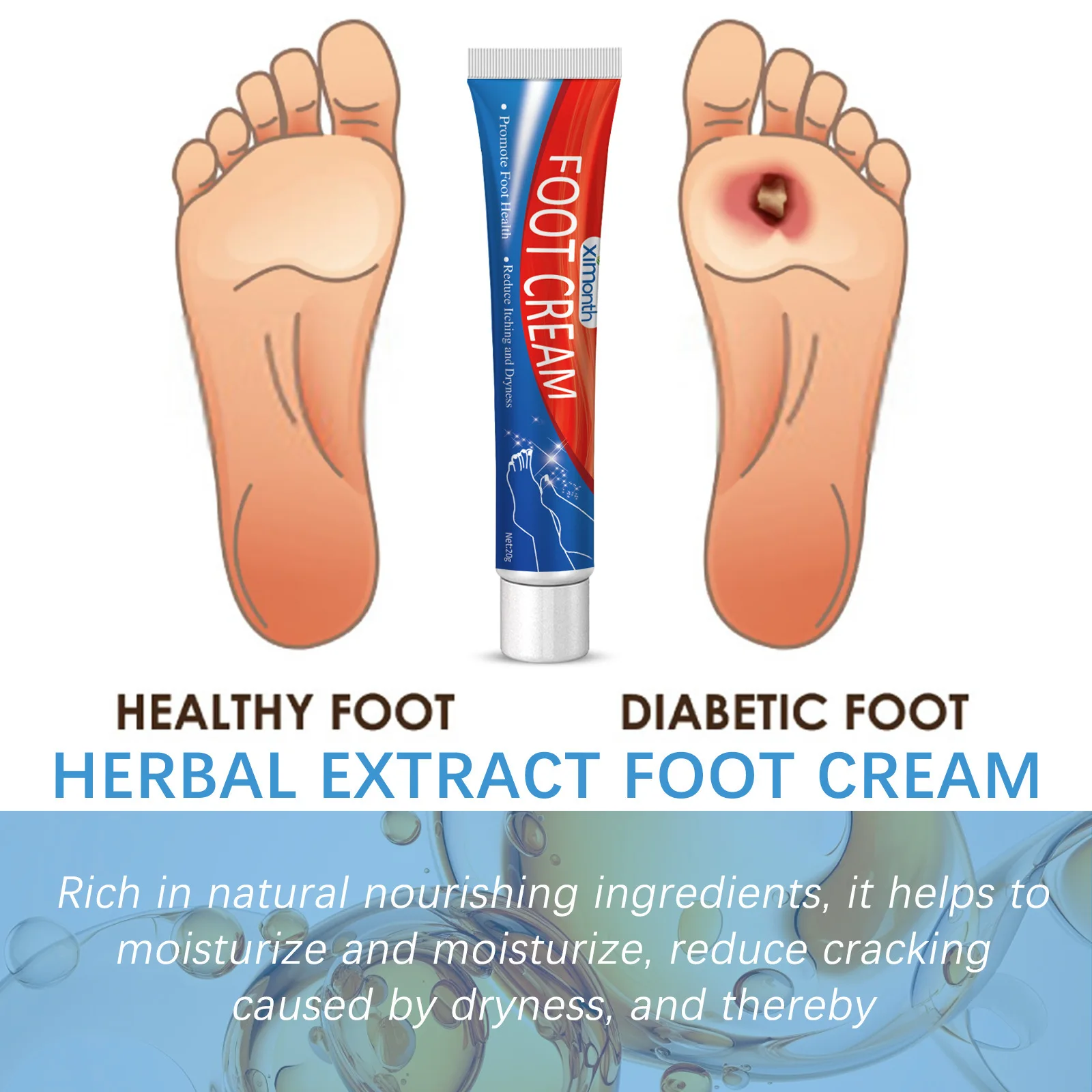 Diabetes Treatment Foot Cream Repair Feet Ulceration Relieve Itchy Improve Heel Cracking Nourishing Blood Sugar Care Ointment