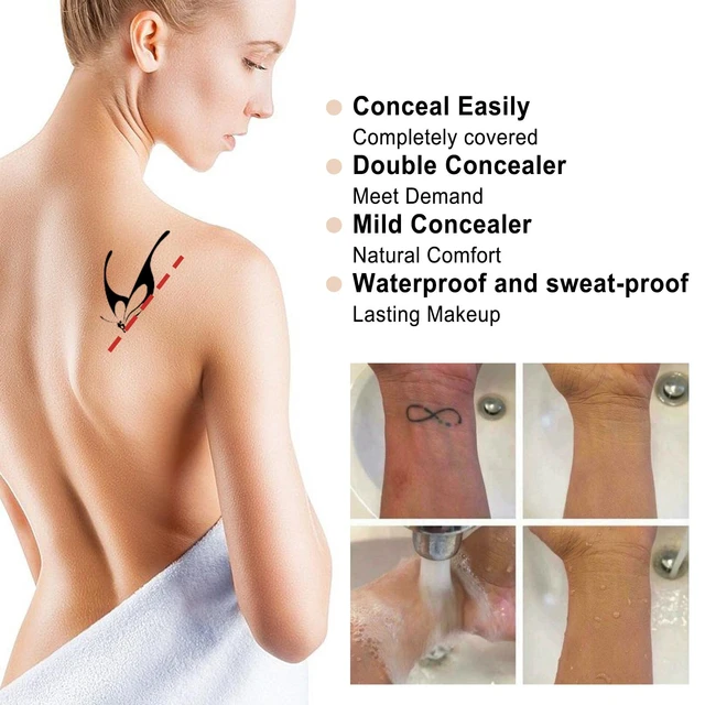 Cosmetic & Medical Tattoo, PMA Clinics - Lyn Quade - Scar Camouflage.  Patients scar was left after she had laser under the armpit. Camouflage  paramedical cosmetic tattoo. Advanced skin needling techniques and