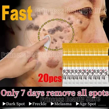 Powerful Spot-removing Whiten Cream Brighten Skin Fast Eliminates Melanin Pigmentation Melasma Dark Spots Moisturize Beauty Gel