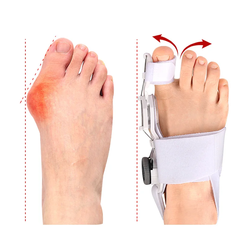 1 PCS Orthopedic Corrector Polyester Foot Bone Protrusion Corrector Skin Friendly Anti-wear for Thumb Correction Foot Care Tool toe corrector