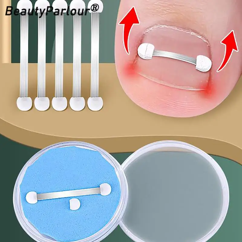 

Ingrown Toenail Corrector Tools Pedicure Recover Embed Toe Nail Treatment Professional Ingrown Toenail Correction Foot Care Tool