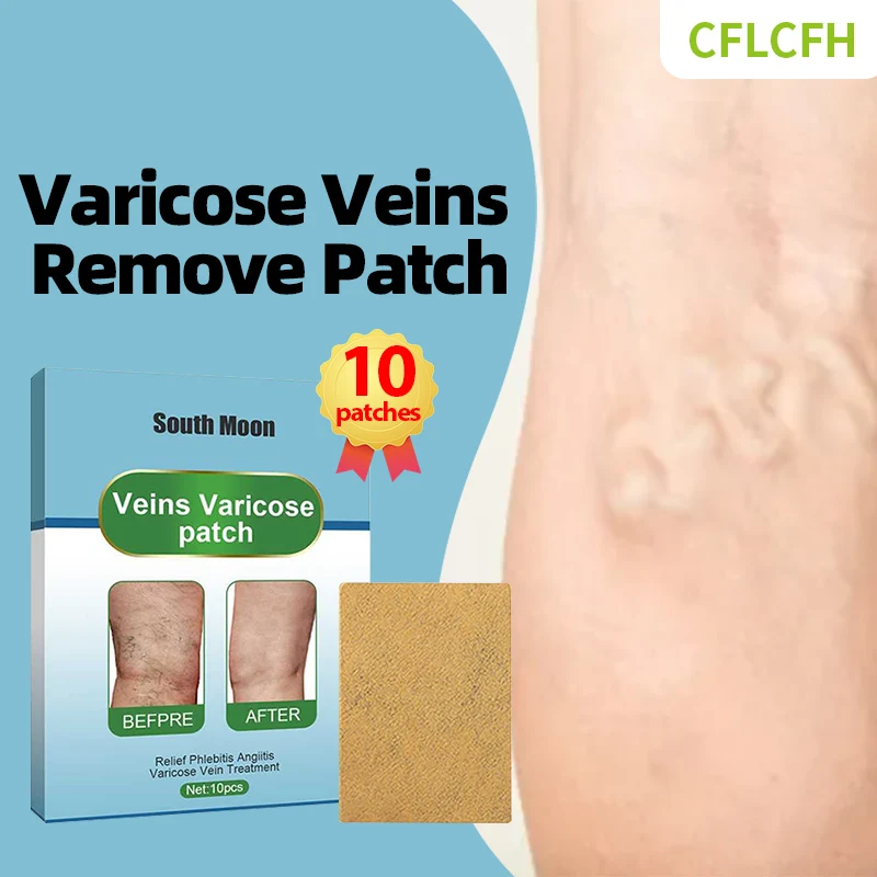 

Varicose Veins Treatment Patch Vasculitis Phlebitis Relief Cream Spider Leg Varicosity Angiitis Legs Dilated Foot Care Medicine