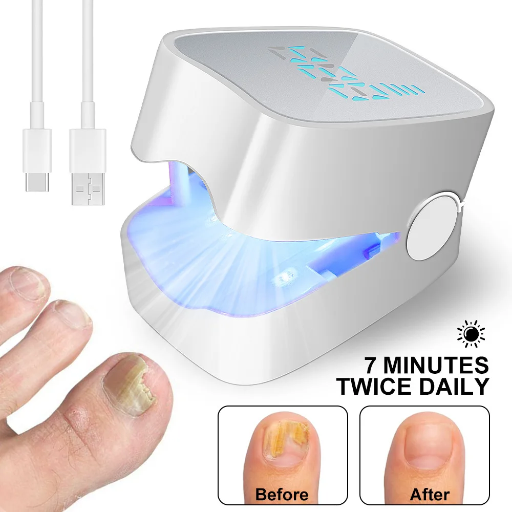 Portable Grey Nail Assist Tool UV Professional Nail Fungus Cleaning Laser Device Nail Phototherapy Lamp Type-C Charging