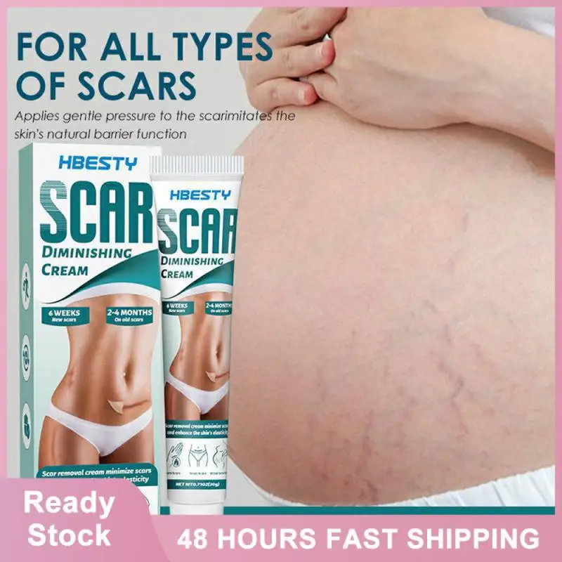 

Scar Cream Strong Permeability Stretch Mark Cream Universal Skin Care Products Scar Care Cream Scar Gel 20g