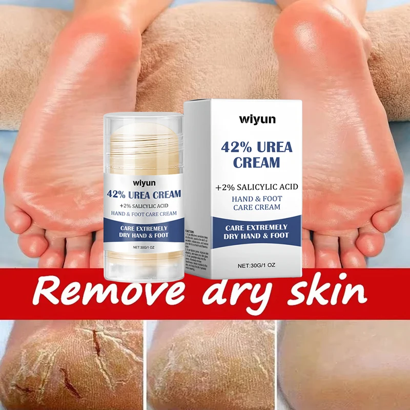 Beauty Product Herbal Anti Crack Foot Cream Heel Cracking Repair Products Exfoliation Dead Skin Removal Softening Moisturize