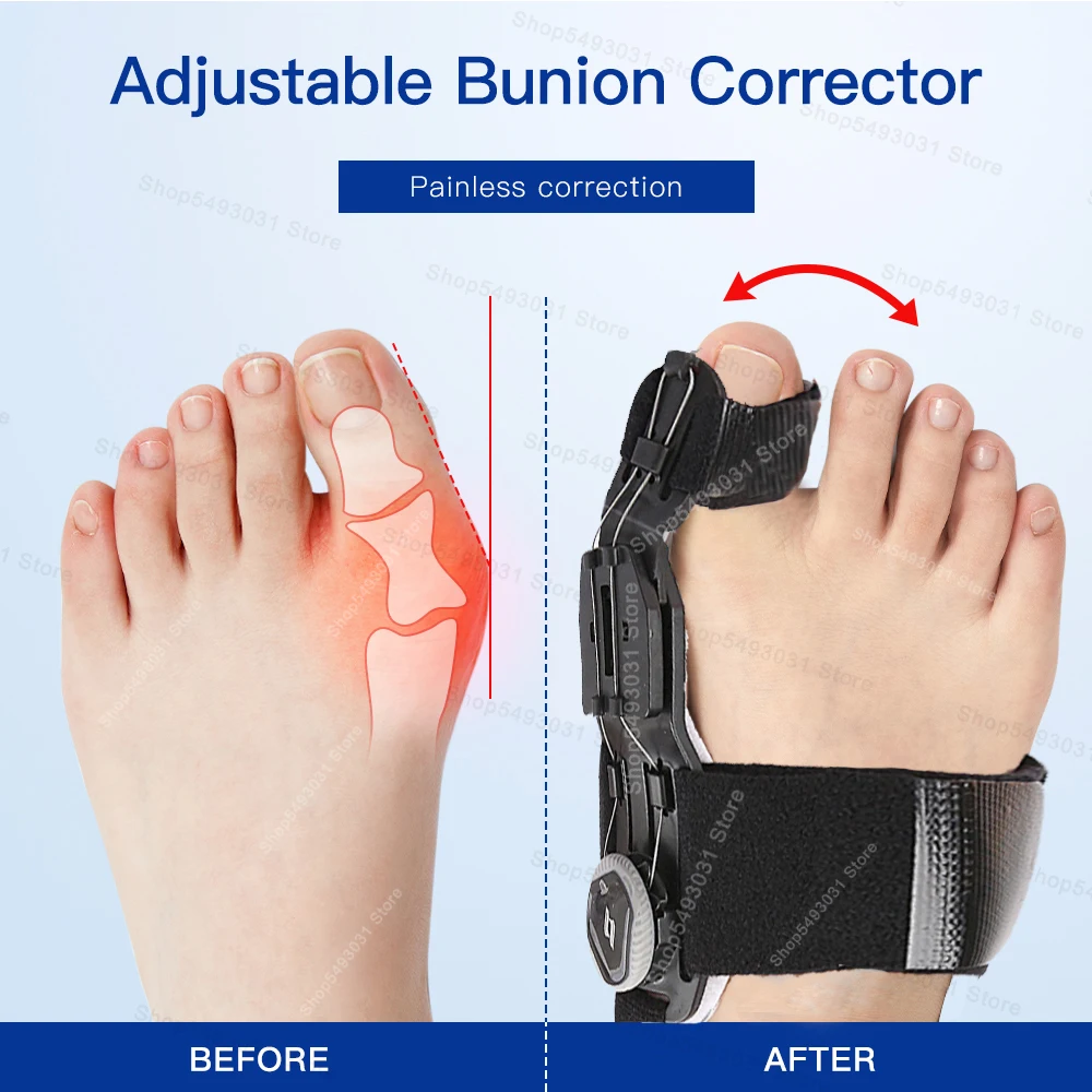 Bunion Corrector Unisex Foot Hallux Valgus Braces Rotatable Toe Separator Straightener Adjustable Pedicure Finger Toe Corrector