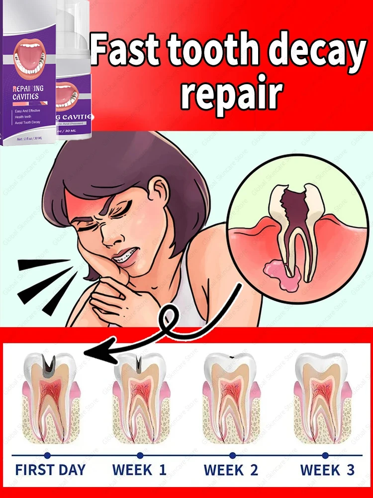 Tooth decay Repair Protect Teeth Remove Plaque Stains Teeth Whitening