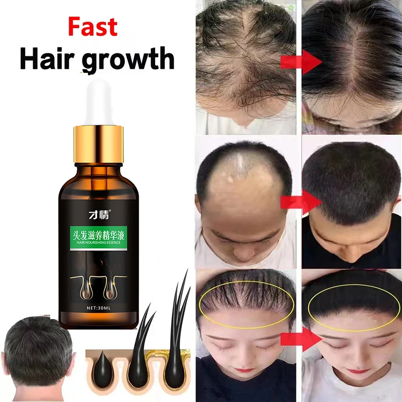 

30ml Nourishes Hair Growth Skin Massage Essential Oil Eyebrows Growth Prevents Skin Aging Hair Care Products free shipping