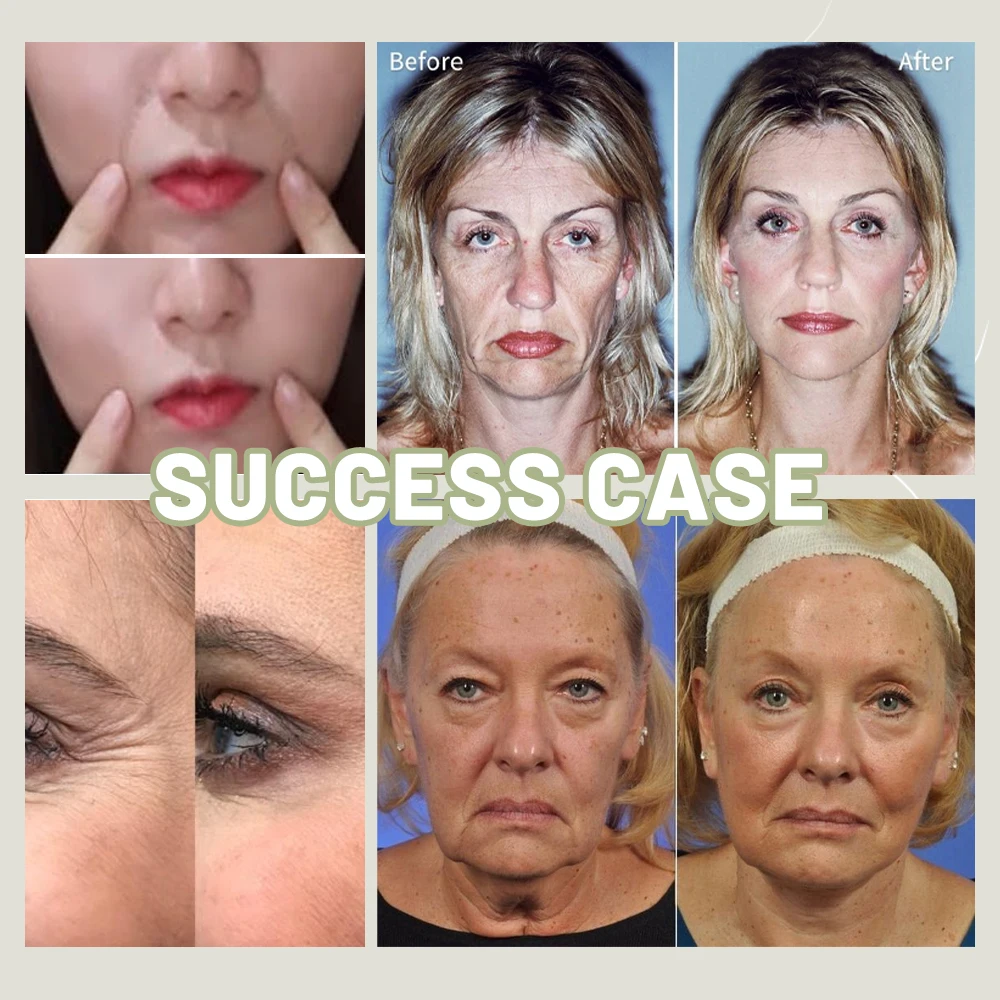Facial Neck Hand Feet Anti-wrinkle Wrinkle Removal Essence Anti aging Serum Skin Care Lift Tighten Reduce Fine Lines Moisturize