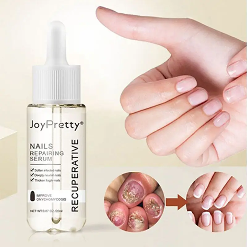 Nail fungus remover 20ml Nail Repairing Serum