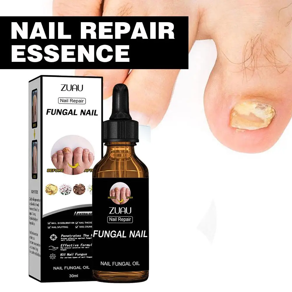 

30ml Nail Repair Solution Thickening Brightening Nails Solution Removing Nail Gray Repair Moisturizing Nail And Nourishing F0P0