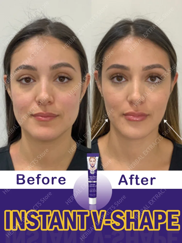 

Face Slimming Cream Cheeks Double Chin Elimination