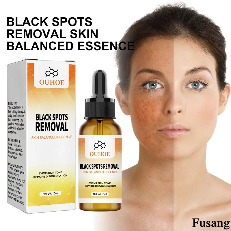 Retinol Effective Brightening Serum Face Remove Spots Whitening Essence Niacinamide Facial Freckles Serum Women Lighten Melasma