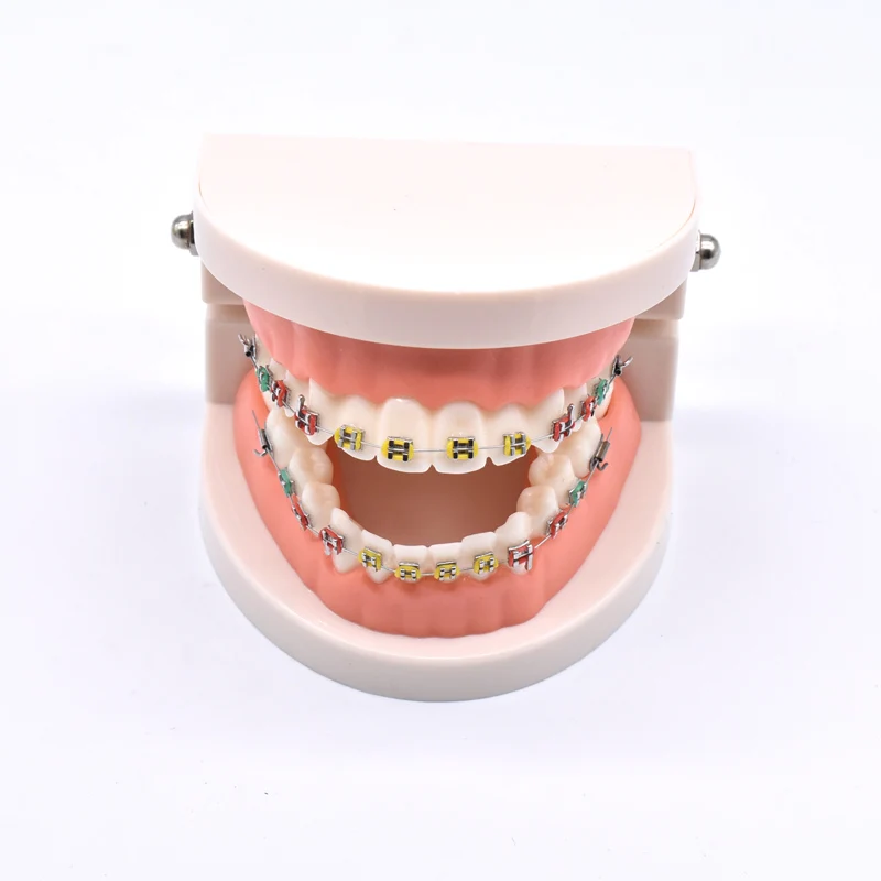 Dental Orthodontic Treatment Teeth Model With Bracket Arch Wire Buccal Tube Ligature Ties Dentist Lab Tooth Model Teaching Tools 4