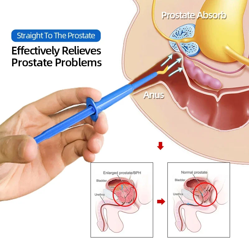 Urologic Prostatic Medical Cold Compress Gel Medicine Treatment Prostate Antibacterial Plaster Cure Prostatitis Herbal Medicine