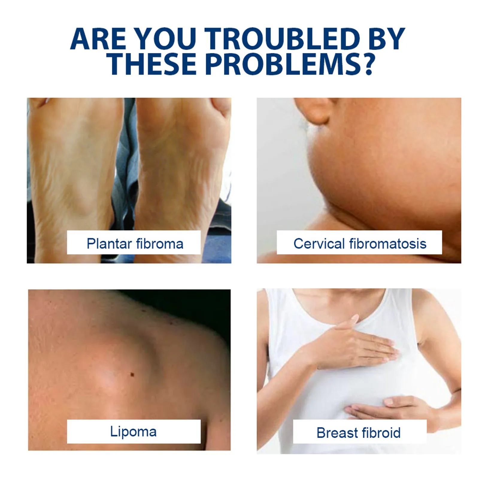 Reduce Lipoma Gel In Organic Material Fast Absorption Reduction Of Inflammation Moisturizing Effect skin care products lipoma removal ointment