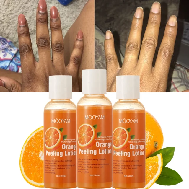 Foot Peeling Lotion Natural Orange Essence Pedicure Hands Dead Skin Exfoliator Mask