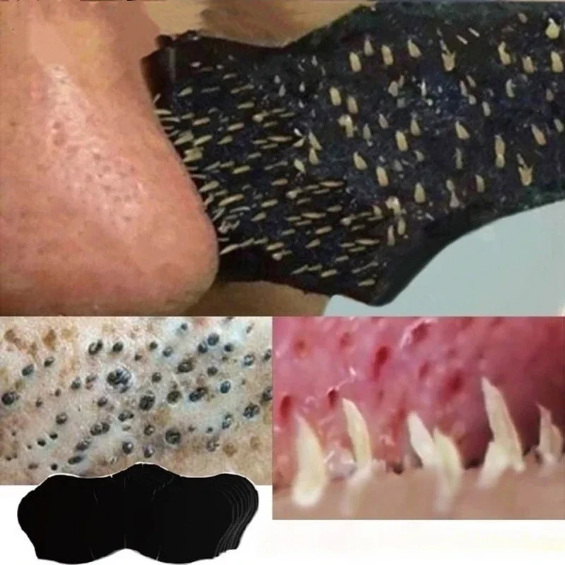 50/100PCS Unisex Blackhead Remove Mask Nasal Strips Shrink Cleansing Pore Nose Black Head Remove Stickers Skin Care Mask Patch 3