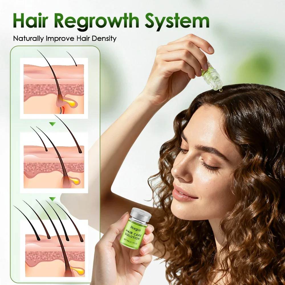 Sistema Avanzato per la Ricrescita dei Capelli, Trattamento Anticaduta con Olio di Ginseng e Rosmarino, Prevenzione della Calvizie, Riparazione dei Danni, Cura dei Capelli - immagine 3
